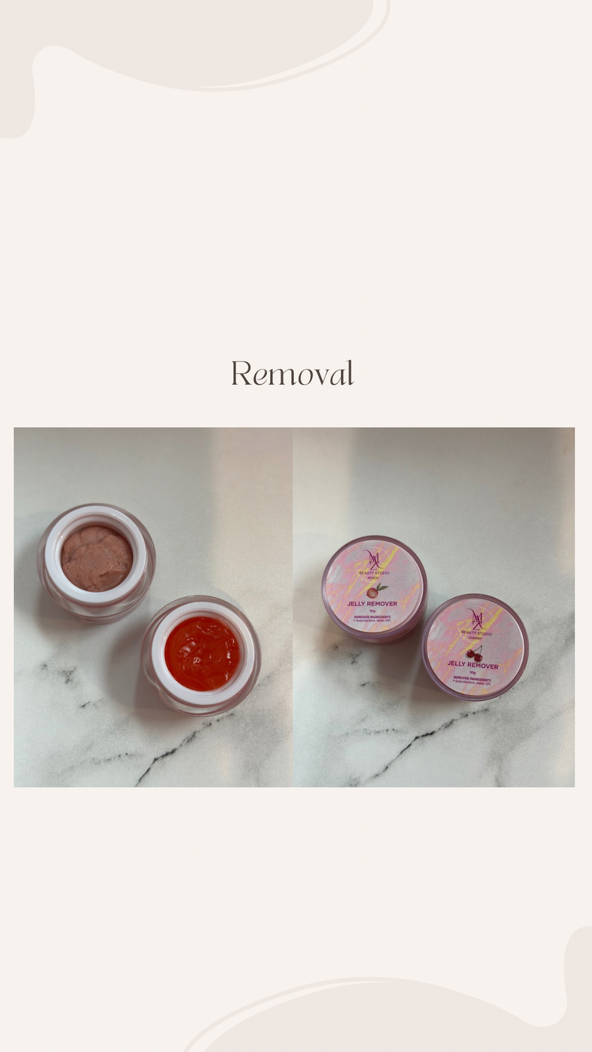 Removal