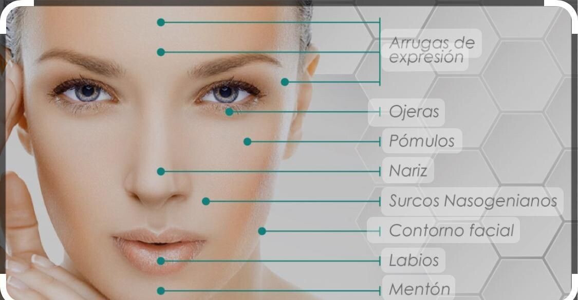 Armonizacion facial