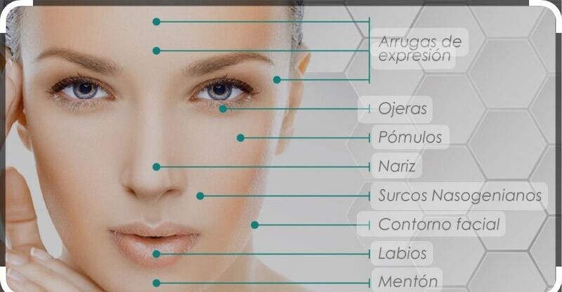 Armonizacion facial
