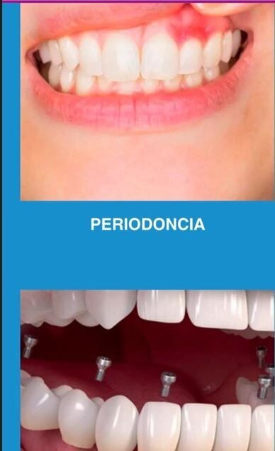 Periodoncia