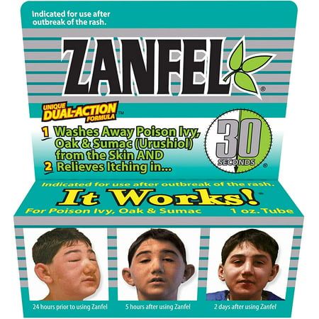 Zanfel Wash Poison Ivy Oak &amp; Sumac 1oz