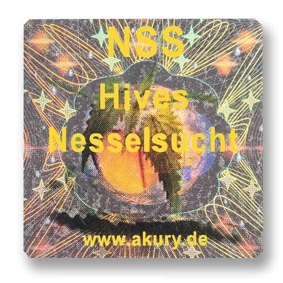 NSS – Nesselsucht