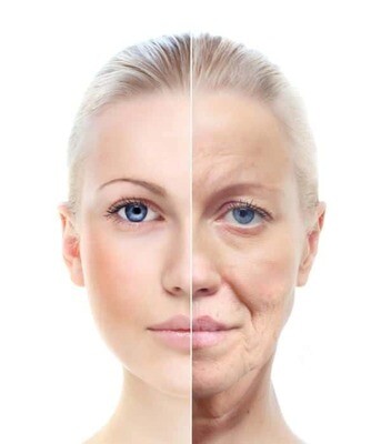 Aging &amp; Sagging