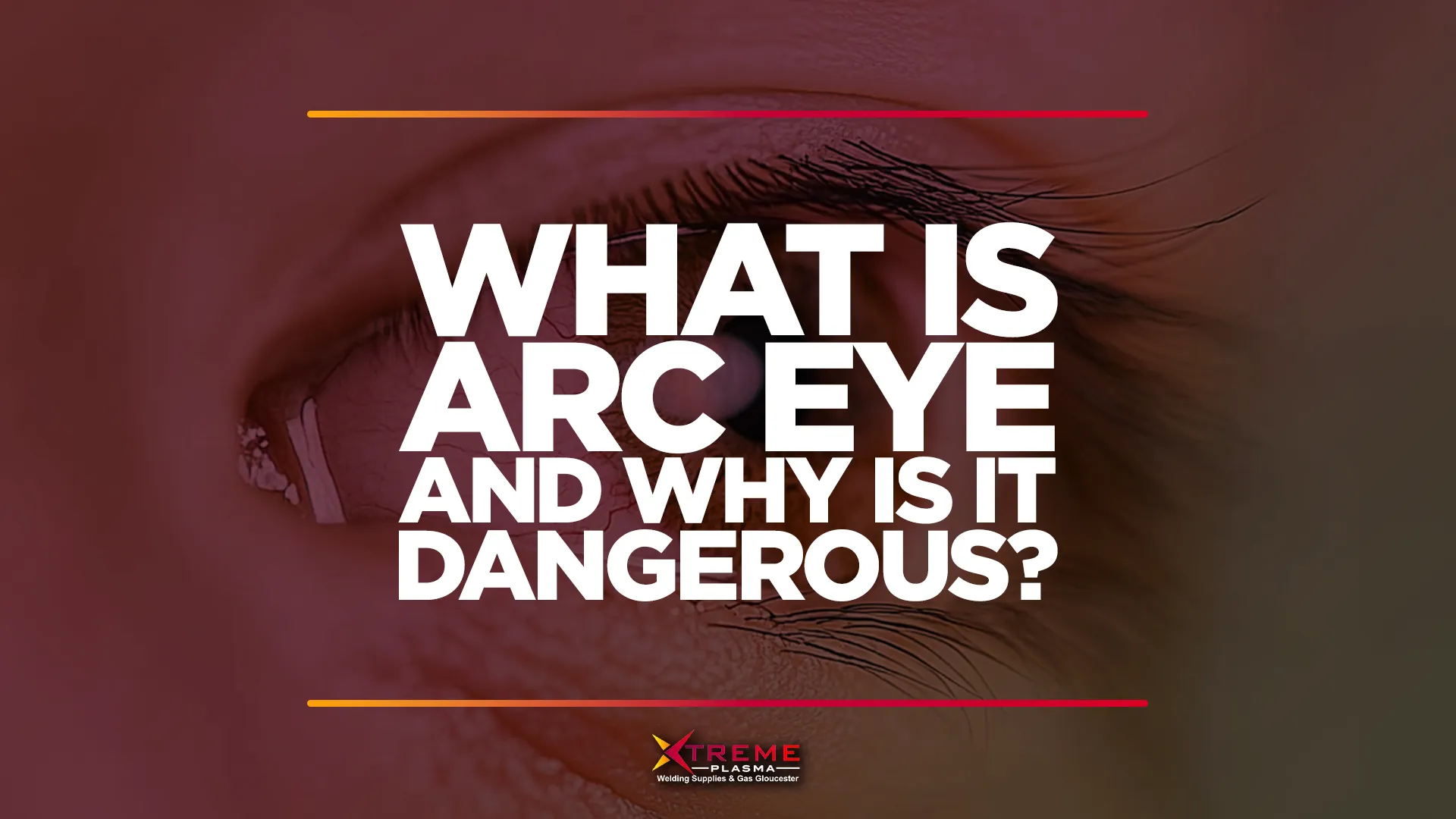 Arc eye main image