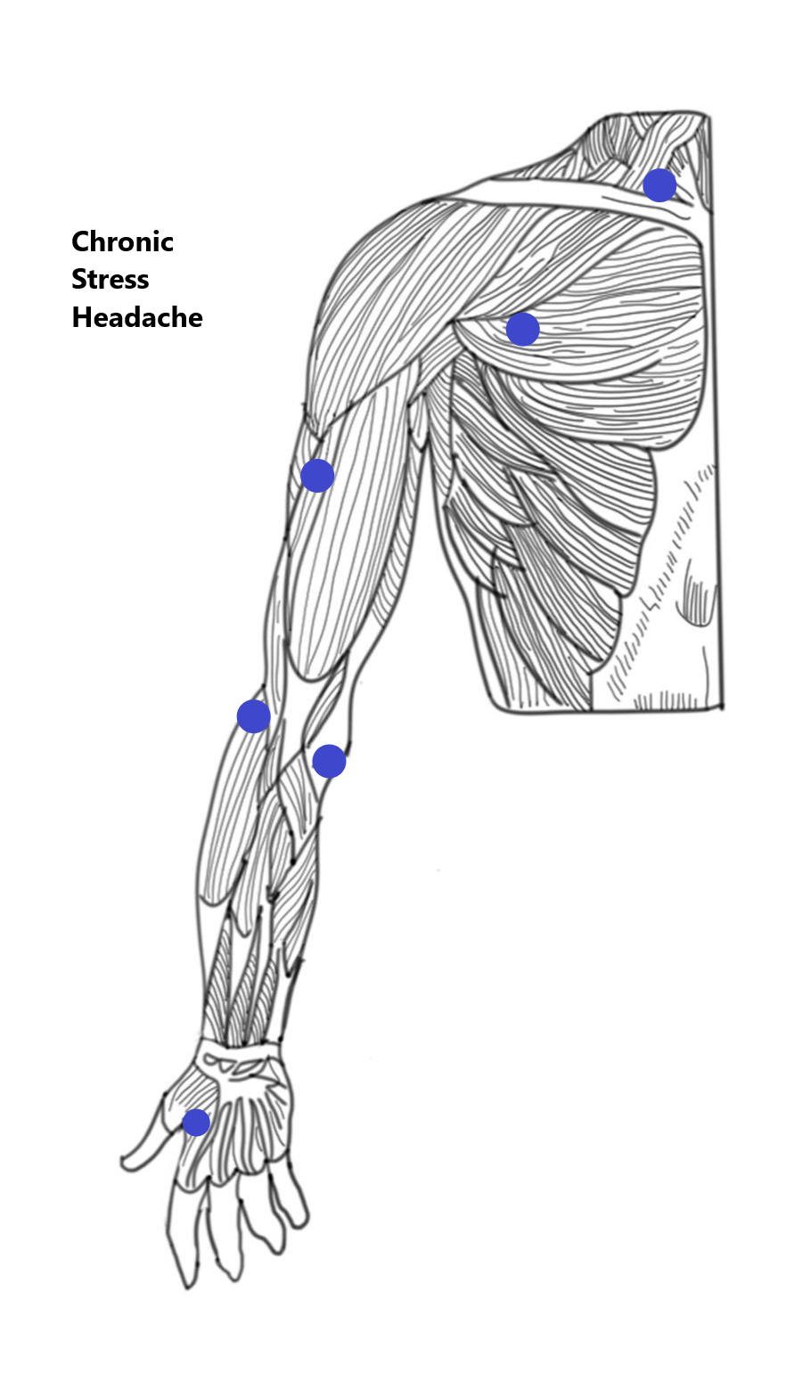 PYRABODY - for the Chronic Stress Headache
