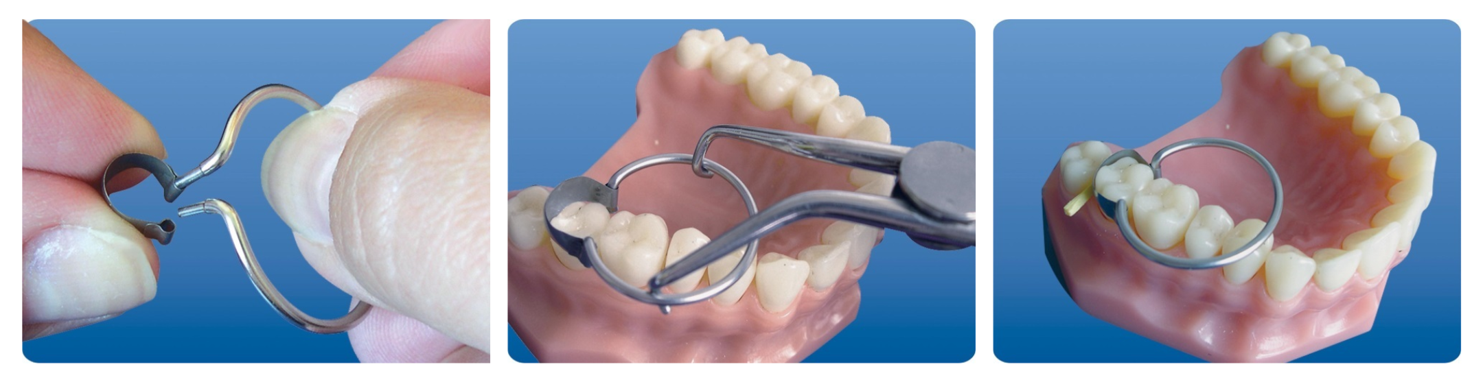 Fixarea matricii cu inel